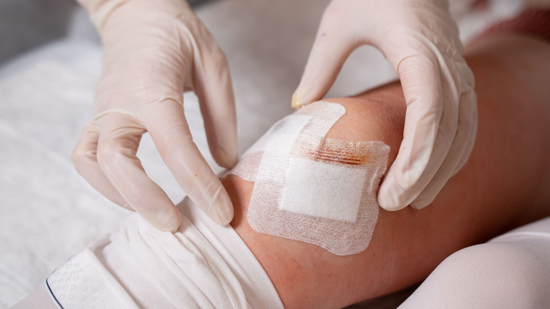 What are the Different Types of Wound Drainage: Top 4 Guide