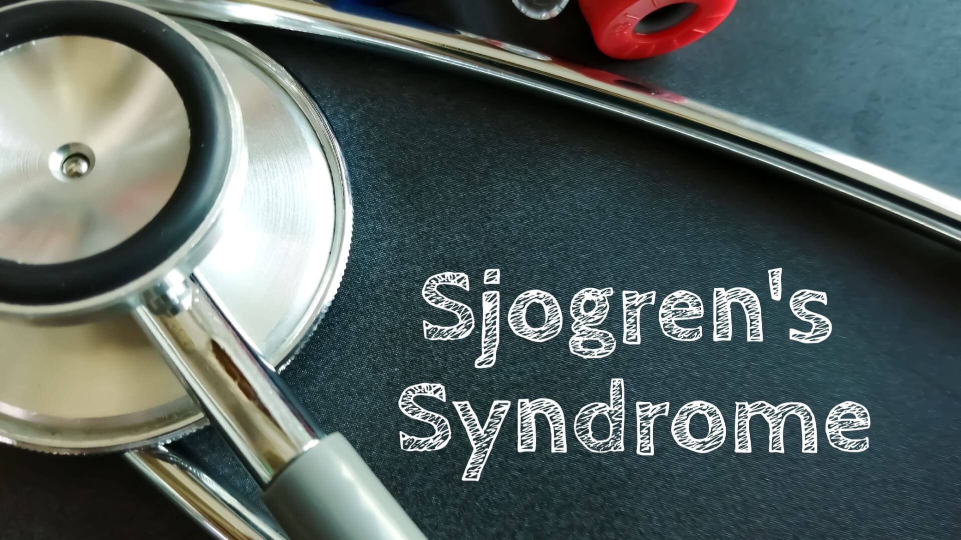 Sjögren’s Syndrome