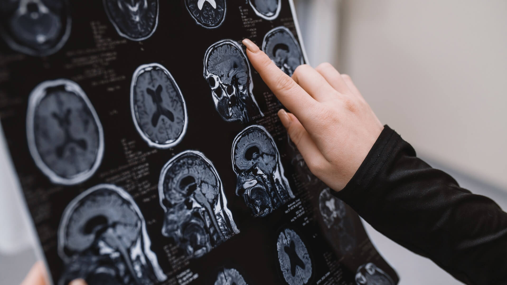 neurological disorders